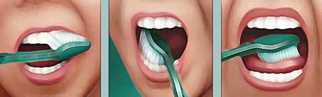 Tips Merawat Gigi Yang Baik, Benar, dan Mudah