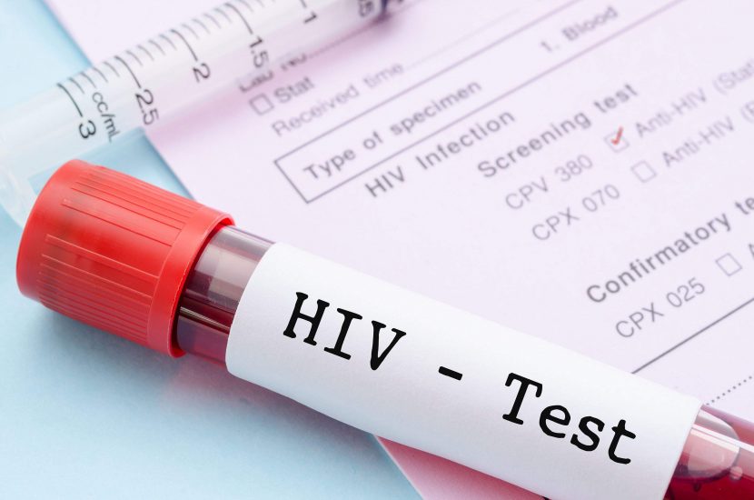Bagaimana Jika Kamu Berstatus HIV Positif? Ini Yang Harus Dilakukan!